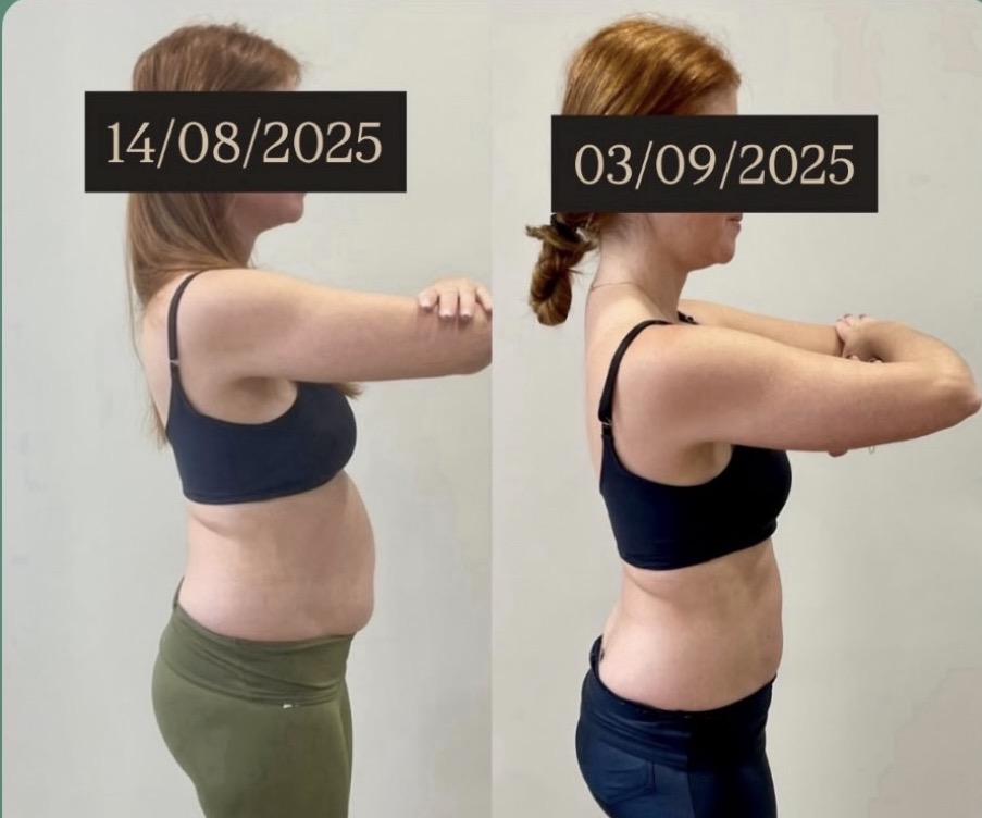 Resultado antes e depois do protocolo ZIPER