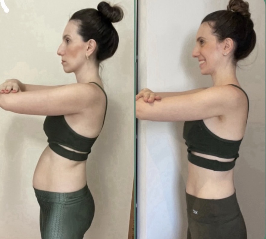 Resultado antes e depois do protocolo ZIPER
