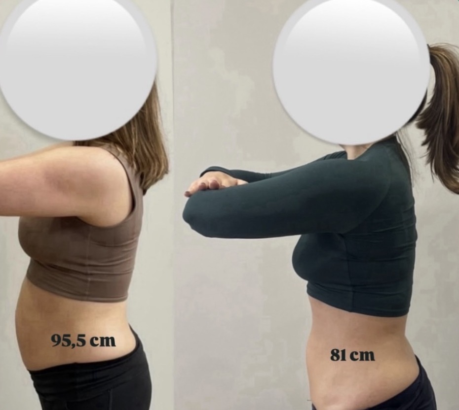 Redução de 95,5 cm para 81 cm de cintura